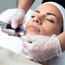 Microneedling Basics: The Pro Skin Method™ Approach